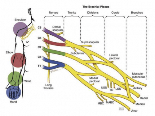 shoulder dystocia brachial plexus injury